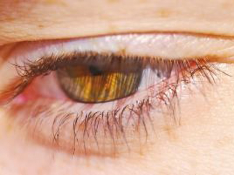 טראומה עקב פציעה